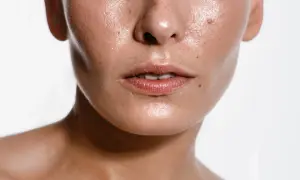 Primo piano del viso lucido, con pori visibili e qualche imperfezione. Scopri come eliminare il sebo in eccesso dal viso per una pelle radiosa.