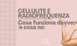 Cellulite e radiofrequenza: cosa funziona davvero (e cosa no). Un programma anticellulite efficace per gambe lisce.