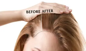 Prima e dopo: capelli più folti grazie ai rimedi della nonna per rinforzare i capelli.