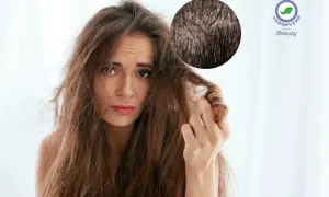 Donna preoccupata per i suoi capelli secchi, con ingrandimento del cuoio capelluto. Scopri i rimedi per capelli secchi.