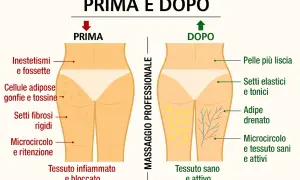 Prima e dopo massaggio professionale: pelle con inestetismi e cellulite prima, liscia e tonica dopo. Ideale per trattamenti anticellulite a casa.