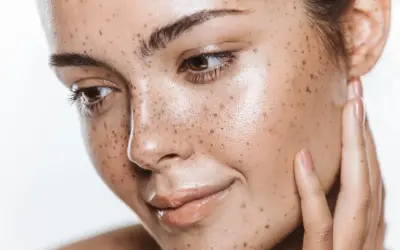 Viso con lentiggini naturali, che ricorda l'effetto dell'autoabbronzante quanto dura. Pelle luminosa e sana.