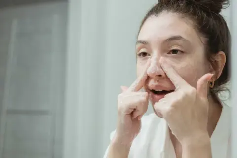 Ragazza si lava il viso, concentrandosi sui brufoli sul naso con schiuma detergente.