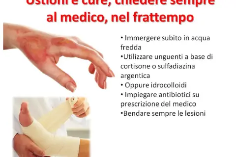Mano ustionata e piede fasciato. Cosa mettere sulle scottature: acqua fredda, unguenti, idrocolloidi o antibiotici su prescrizione.