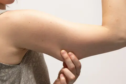Mani che pizzicano la pelle per valutare le braccia flaccide, cercando rimedi della nonna per rassodare.