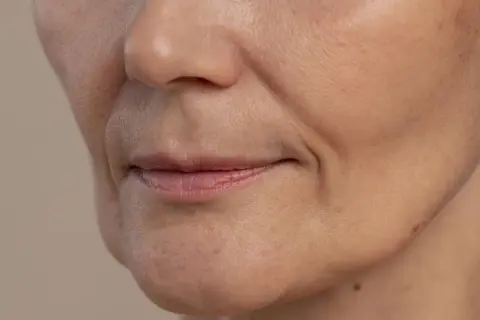 Primo piano del viso con pori dilatati visibili, texture della pelle e lievi rughe intorno alla bocca.