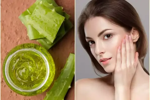 Gel di aloe vera e foglie fresche, per scoprire i benefici per la pelle.