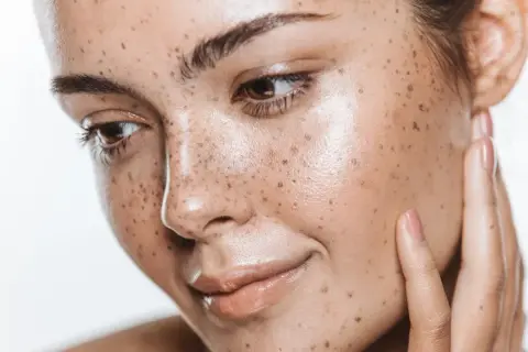 Viso con lentiggini naturali, che ricorda l'effetto dell'autoabbronzante quanto dura. Pelle luminosa e sana.