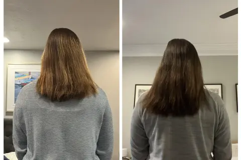 Due immagini affiancate mostrano i capelli di una persona, che sembrano non crescere.