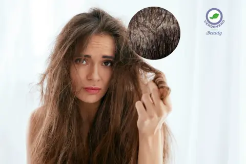 Donna preoccupata per i suoi capelli secchi, con ingrandimento del cuoio capelluto. Scopri i rimedi per capelli secchi.