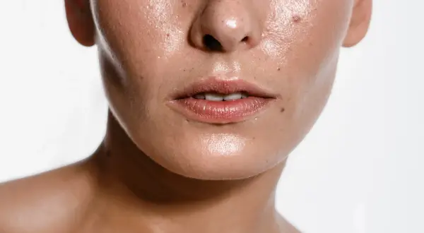 Primo piano del viso lucido, con pori visibili e qualche imperfezione. Scopri come eliminare il sebo in eccesso dal viso per una pelle radiosa.
