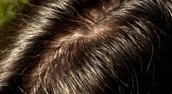 Primo piano di capelli scuri e lucidi, con alcune ciocche che mostrano la tendenza ad apparire unti.