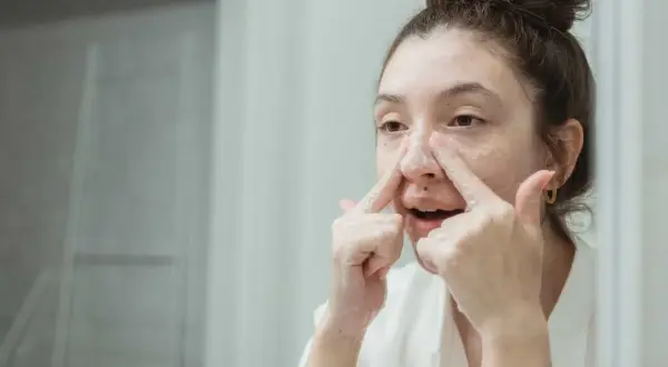 Ragazza si lava il viso, concentrandosi sui brufoli sul naso con schiuma detergente.