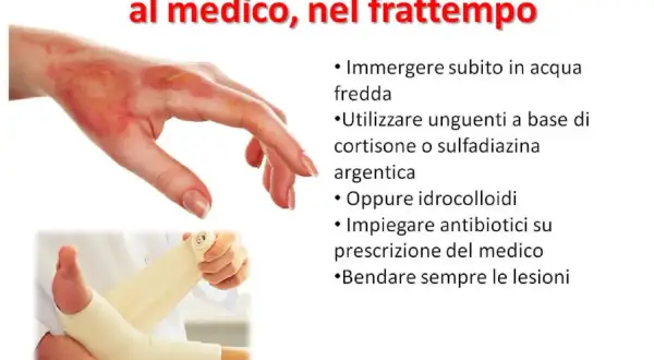 Mano ustionata e piede fasciato. Cosa mettere sulle scottature: acqua fredda, unguenti, idrocolloidi o antibiotici su prescrizione.