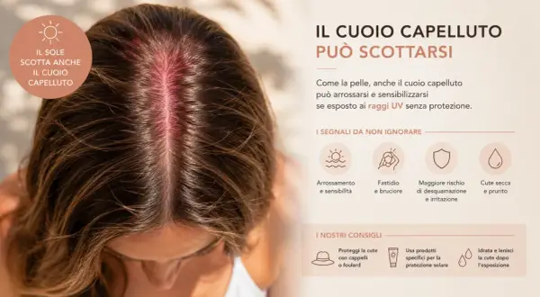 Cuoio capelluto arrossato dal sole, con indicazioni sui danni solari e consigli per la protezione.