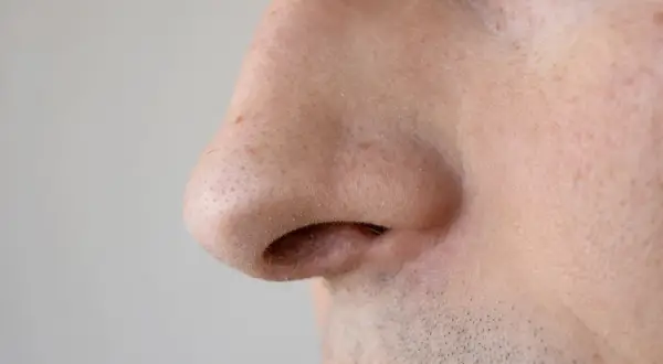 Primo piano del naso di un uomo, con pori dilatati visibili sulla pelle.