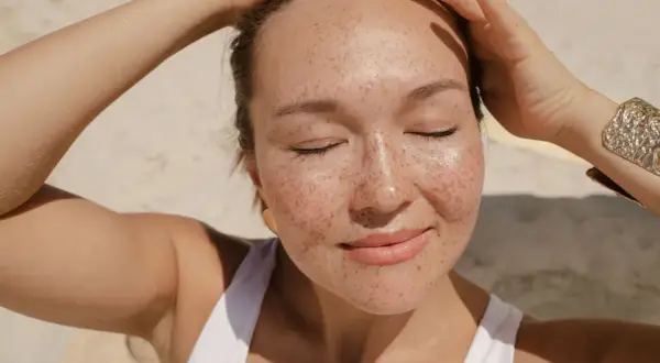 Donna con lentiggini al sole, con le mani tra i capelli. Forse la crema solare tutti i giorni fa male?