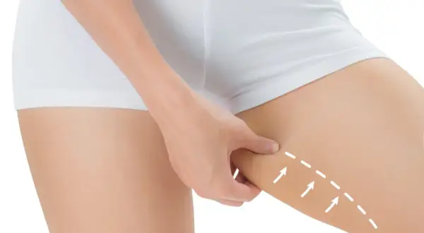 Mano che pizzica la pelle flaccida interno coscia, con frecce bianche che indicano un'area da trattare.
