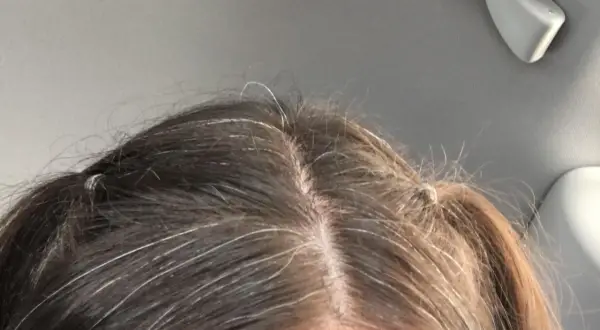 Capelli scuri con fili bianchi evidenti. La ricrescita è visibile, segno che si può fare la tinta ogni 15 giorni per un look sempre curato.