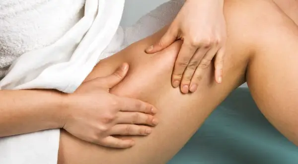 Mani che massaggiano la coscia, evidenziando la cellulite edematosa e fibrosa.