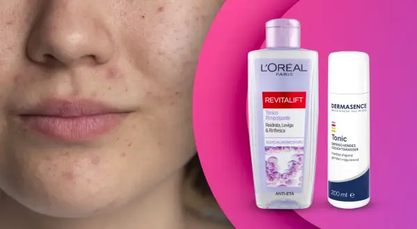 Viso con imperfezioni e due flaconi di tonico, uno L'Oréal Revitalift, l'altro Dermasence, per una pelle giovane e luminosa.