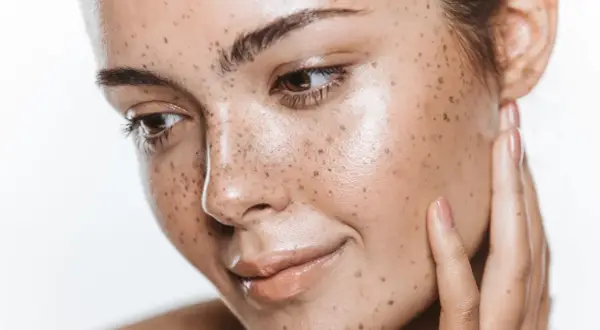 Viso con lentiggini naturali, che ricorda l'effetto dell'autoabbronzante quanto dura. Pelle luminosa e sana.