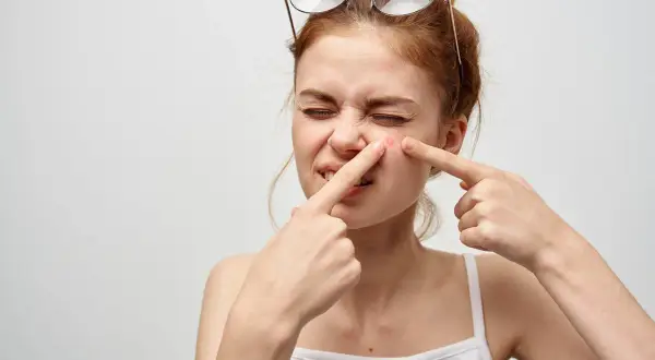 Ragazza con occhiali in testa che si tocca un brufolo, un fastidioso punto nero che si riforma sempre.