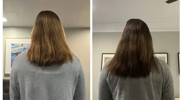 Due immagini affiancate mostrano i capelli di una persona, che sembrano non crescere.