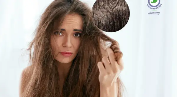 Donna preoccupata per i suoi capelli secchi, con ingrandimento del cuoio capelluto. Scopri i rimedi per capelli secchi.