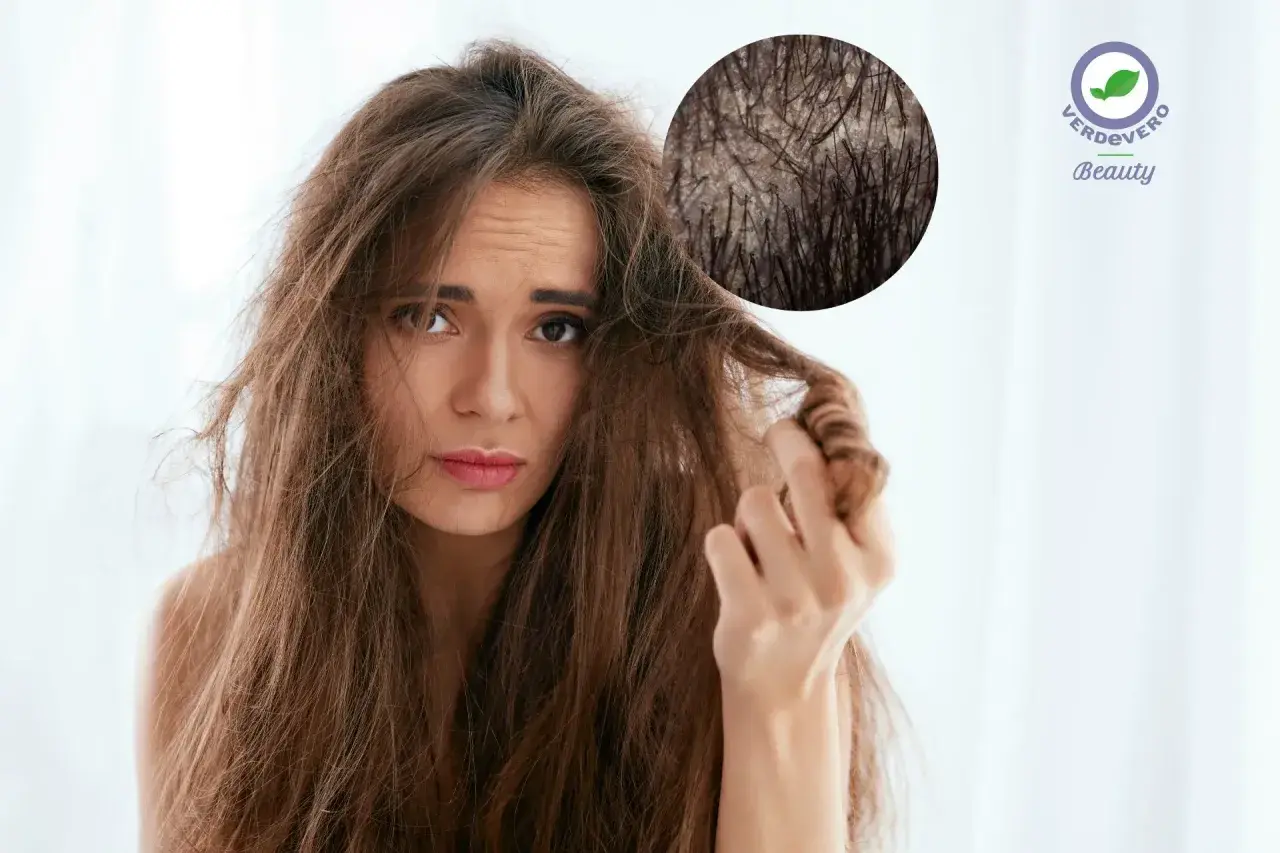 Donna preoccupata per i suoi capelli secchi, con ingrandimento del cuoio capelluto. Scopri i rimedi per capelli secchi.