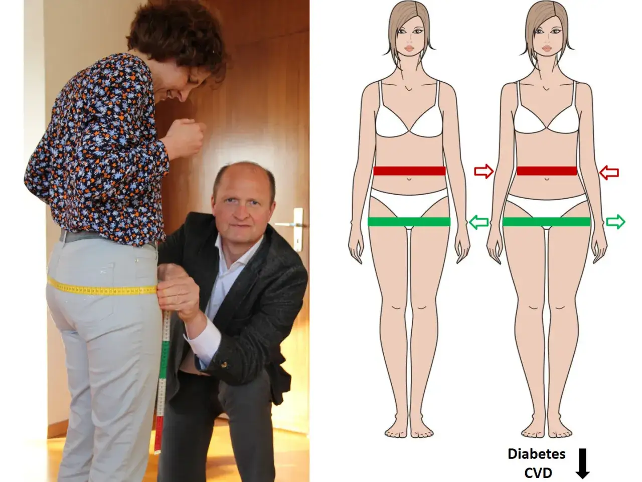 Misurazione dei fianchi larghi, con illustrazione che mostra la relazione tra circonferenza vita-fianchi e rischio diabete/malattie cardiovascolari.