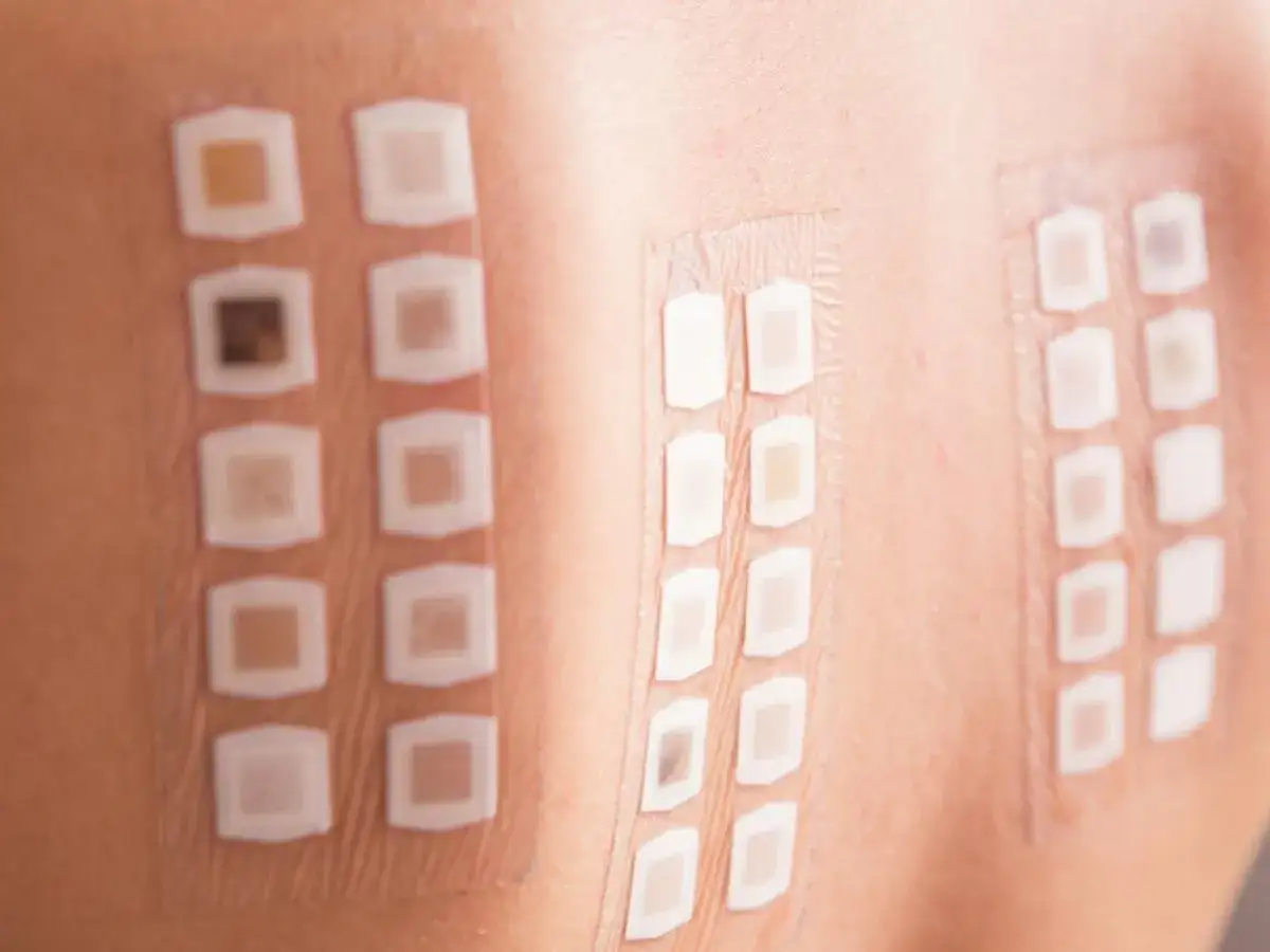 Patch test cutanei per valutare allergie. Si indaga anche su possibili bava delle lumache controindicazioni.