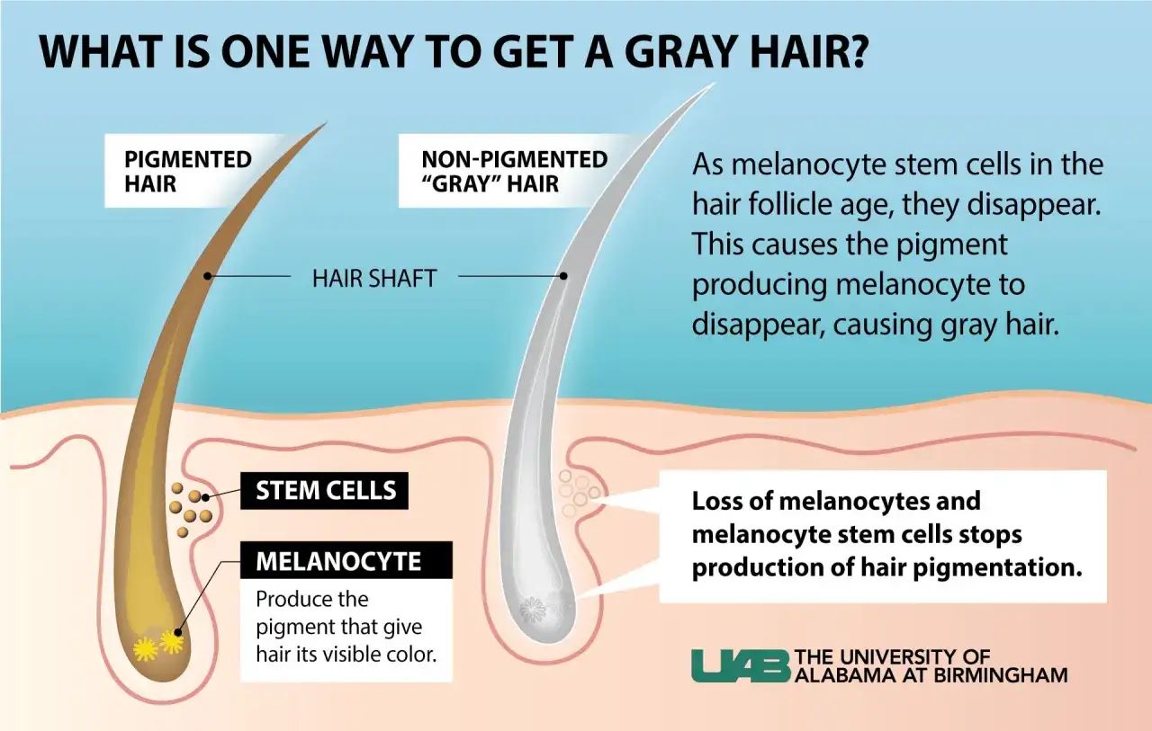 Illustrazione scientifica che mostra come i capelli perdono pigmento con l'età, causando capelli bianchi da stress.