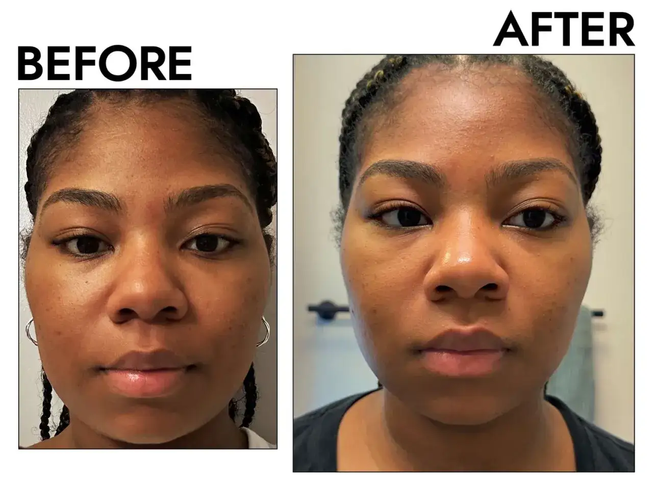 Prima e dopo: la pelle appare più luminosa e uniforme. Chissà quante volte fare lo scrub viso per ottenere questo risultato.