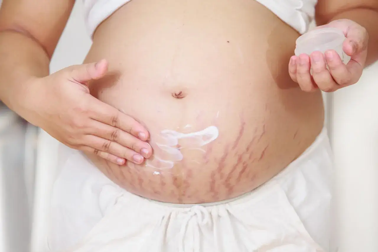Pancia di donna incinta con crema e inizio smagliature gravidanza.