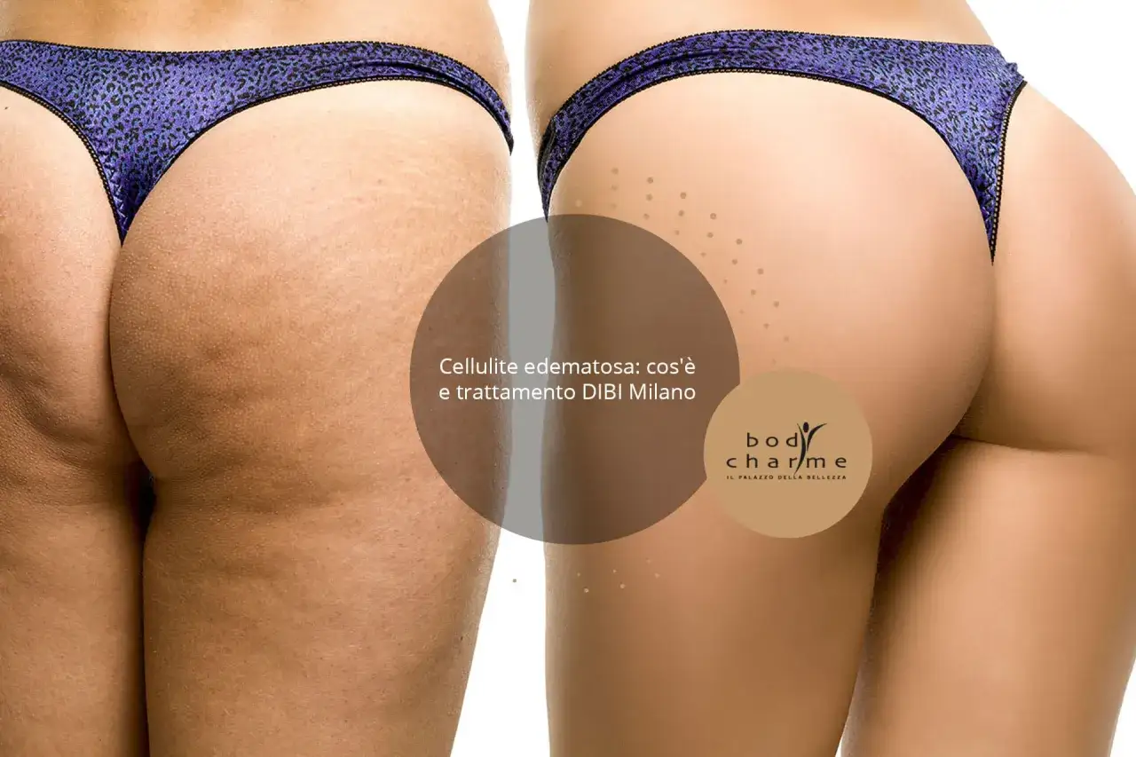 Prima e dopo: pelle con cellulite edematosa e fibrosa trattata con successo.