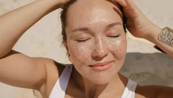Donna con lentiggini al sole, con le mani tra i capelli. Forse la crema solare tutti i giorni fa male?
