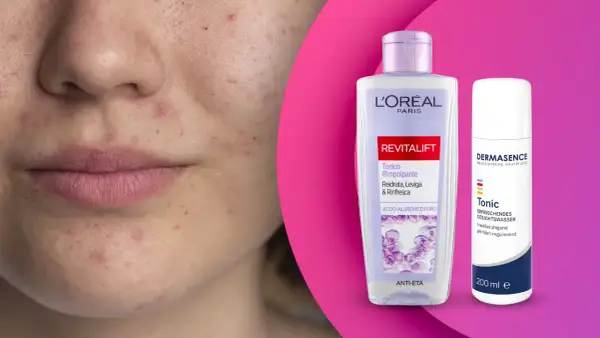 Viso con imperfezioni e due flaconi di tonico, uno L'Oréal Revitalift, l'altro Dermasence, per una pelle giovane e luminosa.