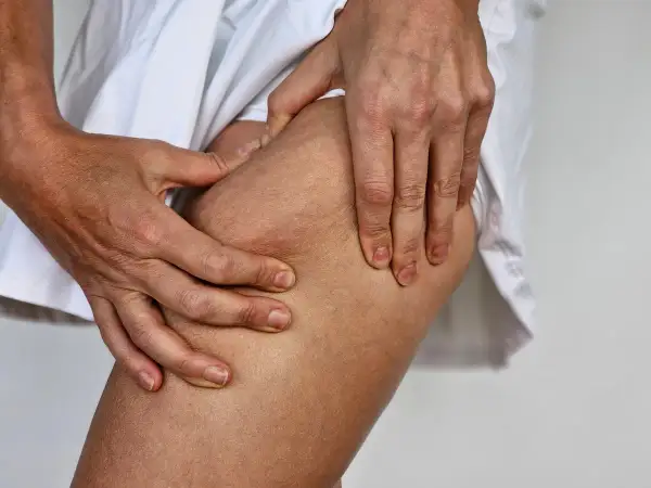 Mani che stringono la coscia, evidenziando la texture della pelle con cellulite e noduli sottopelle.