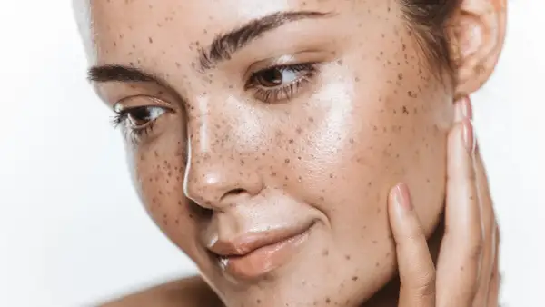 Viso con lentiggini naturali, che ricorda l'effetto dell'autoabbronzante quanto dura. Pelle luminosa e sana.