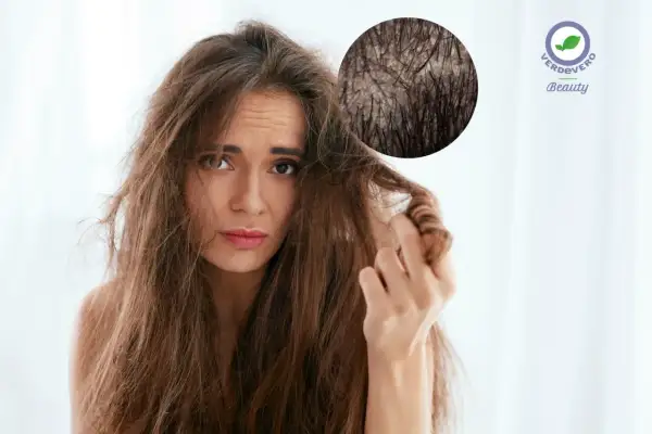 Donna preoccupata per i suoi capelli secchi, con ingrandimento del cuoio capelluto. Scopri i rimedi per capelli secchi.